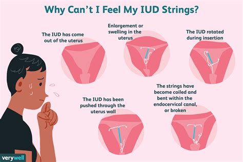 If anything particularly weird keeps happening then ask about it at your follow-up. . Iud strings longer